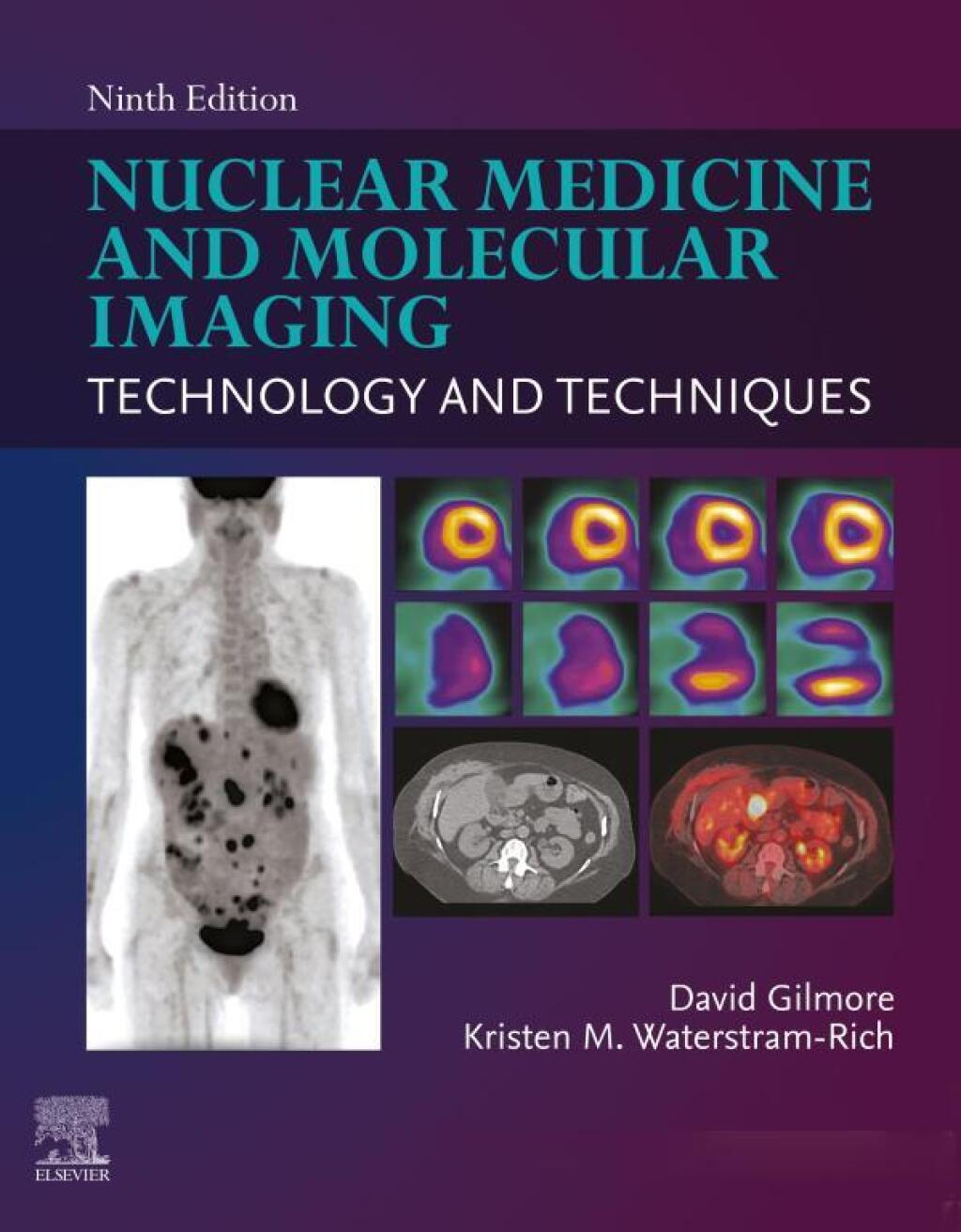Nuclear Medicine and Molecular Imaging 9e Gilmore Test Bank