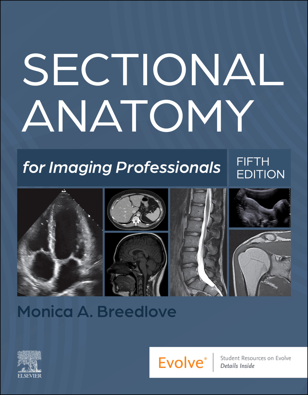 Sectional Anatomy for Imaging Professionals 5e Breedlove Test Bank