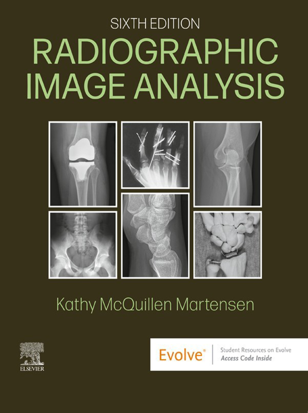 Radiographic Image Analysis 6e Martensen Test Bank