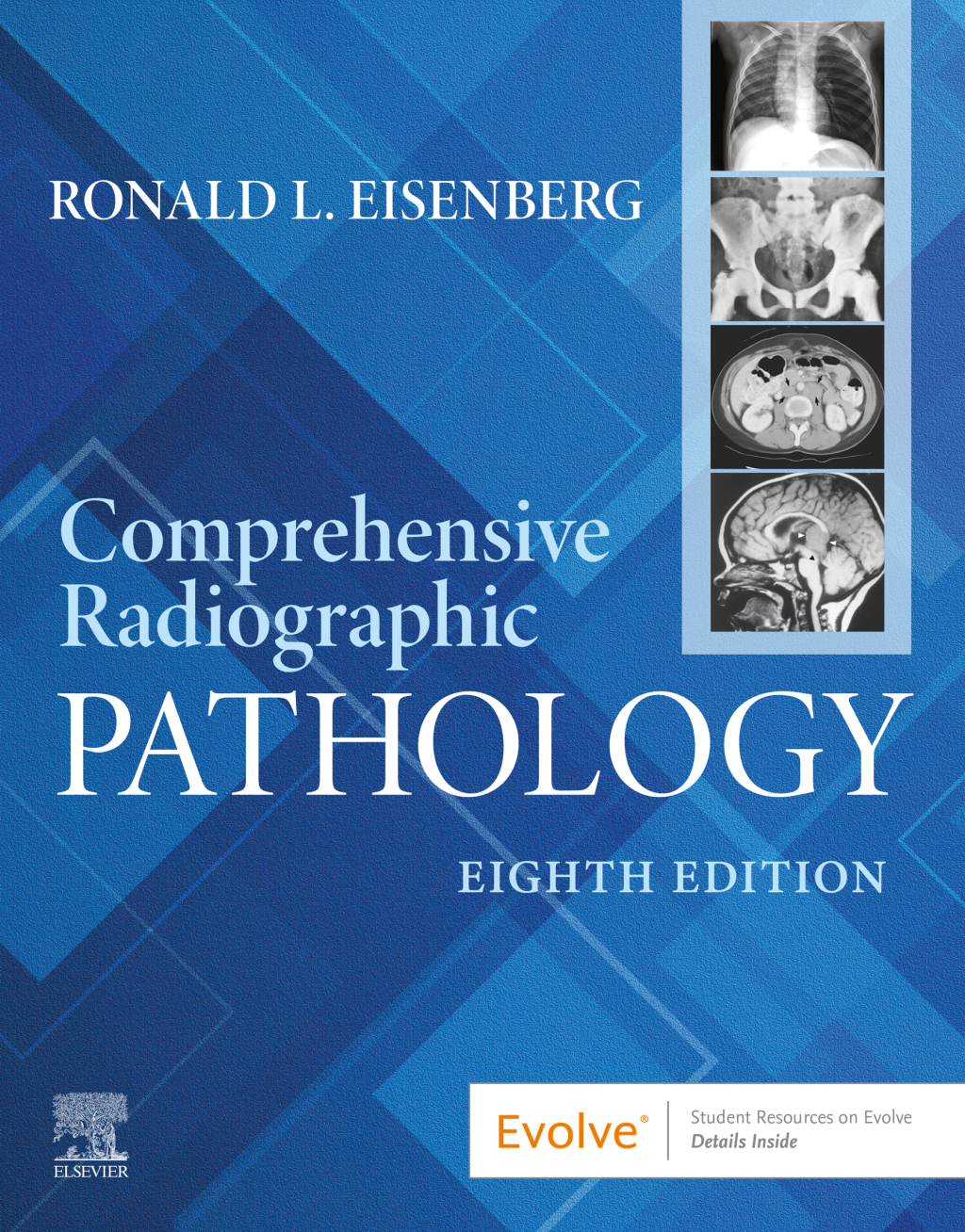 Comprehensive Radiographic Pathology 8e Eisenberg Test Bank